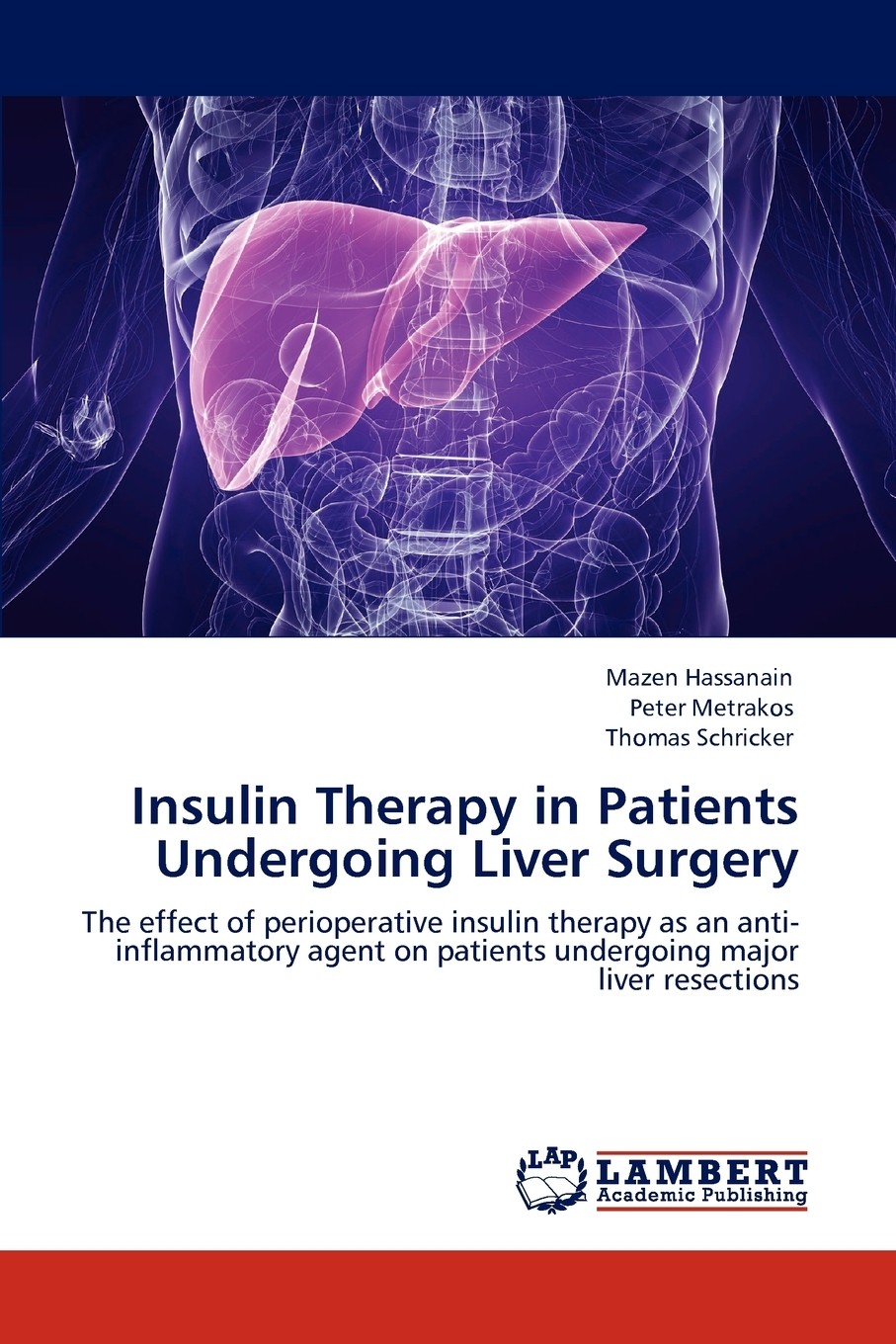 【预售 按需印刷】insulin therapy in patients undergoing liver