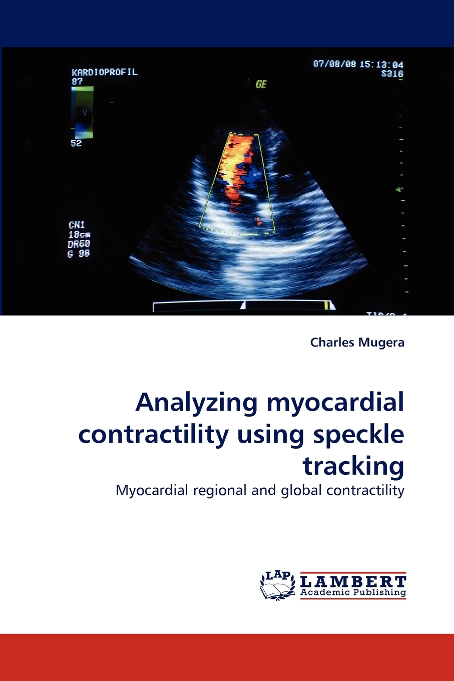 【预售按需印刷】Analyzing Myocardial Contractility Using Speckle Tracking