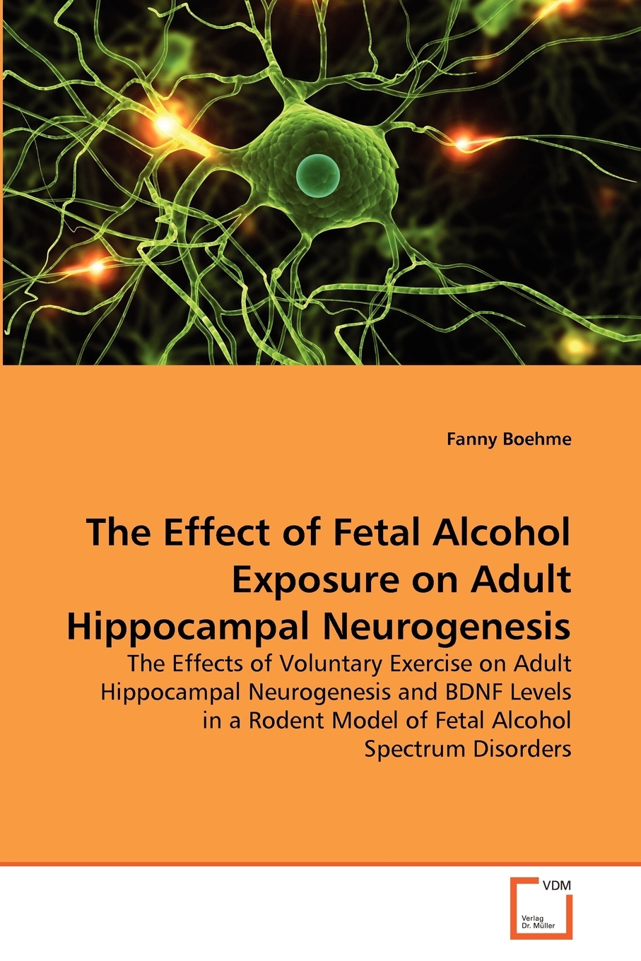 【预售按需印刷】The Effect of Fetal Alcohol Exposure on Adult Hippocampal Neurogenesis