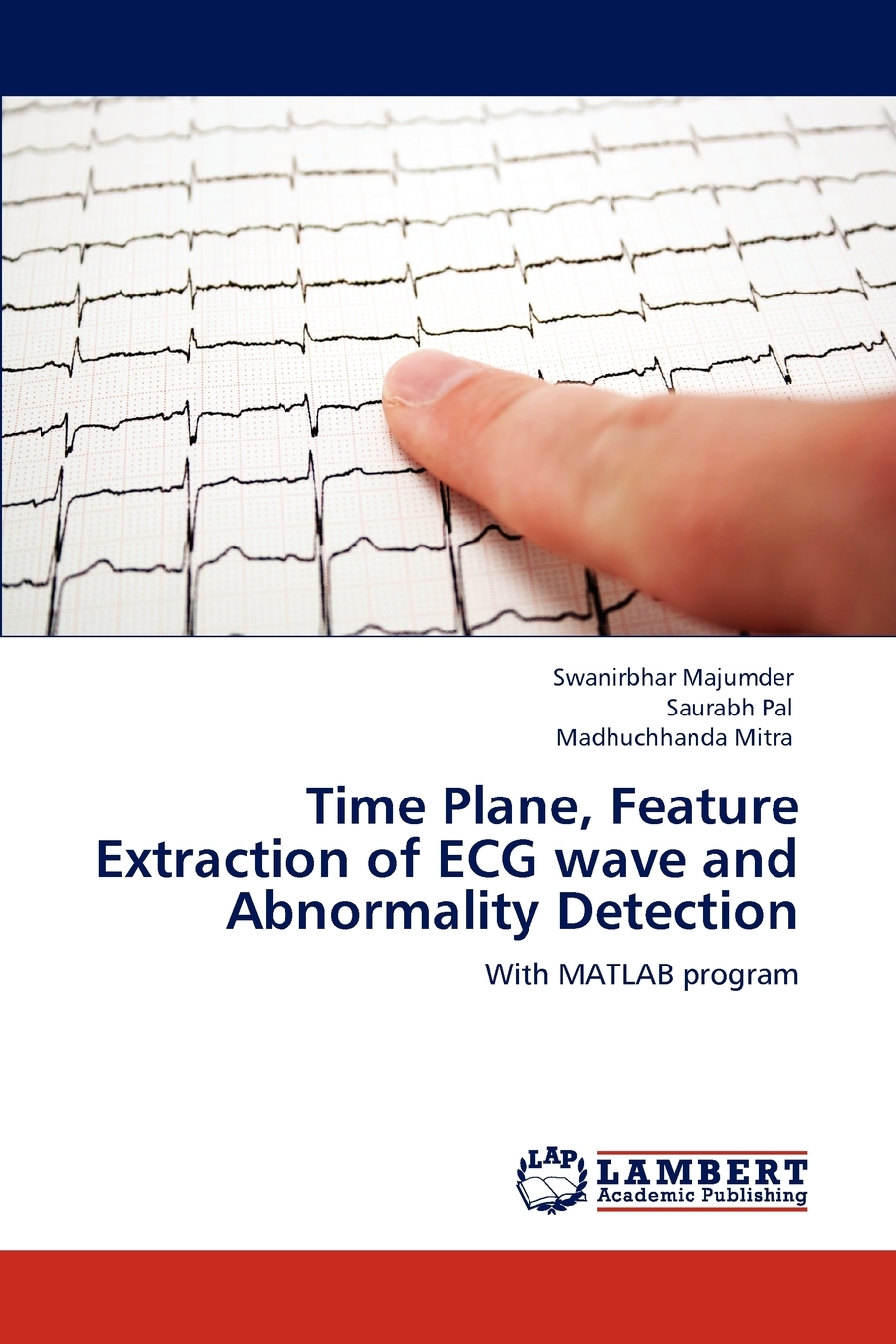 【预售按需印刷】Time Plane Feature Extraction of ECG wave and Abnormality Detection