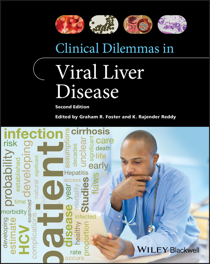 预售 按需印刷 clinical dilemmas in viral liver 2e p
