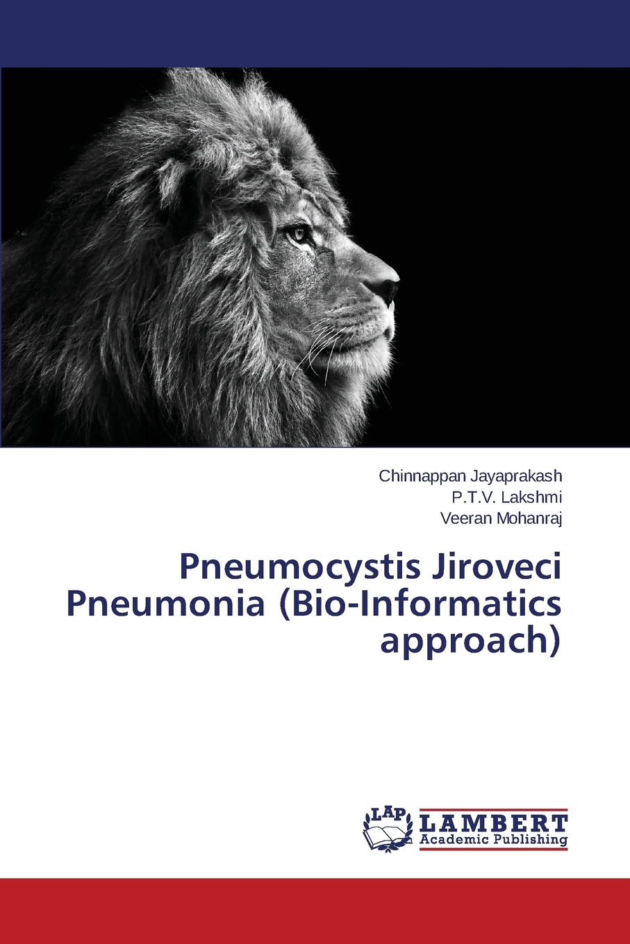【预售 按需印刷】pneumocystis jiroveci pneumonia (bio