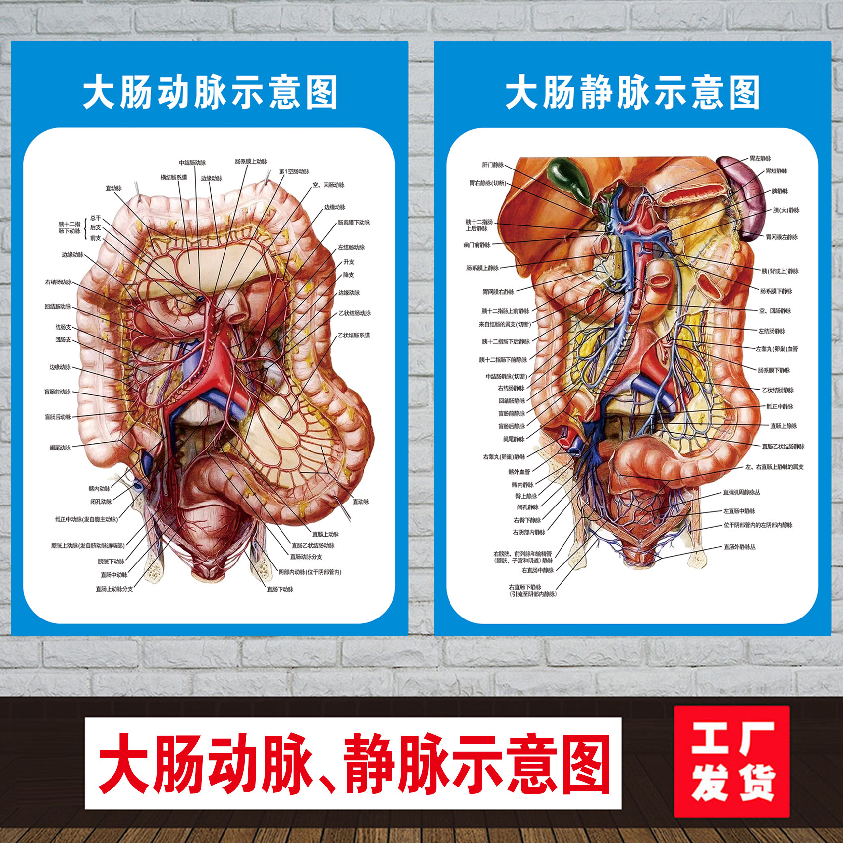 人体内脏器官大肠动脉静脉血管不正常消化肠道系统医学挂图海报