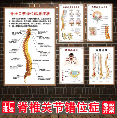 人体椎间盘常见病变医院挂图海报
