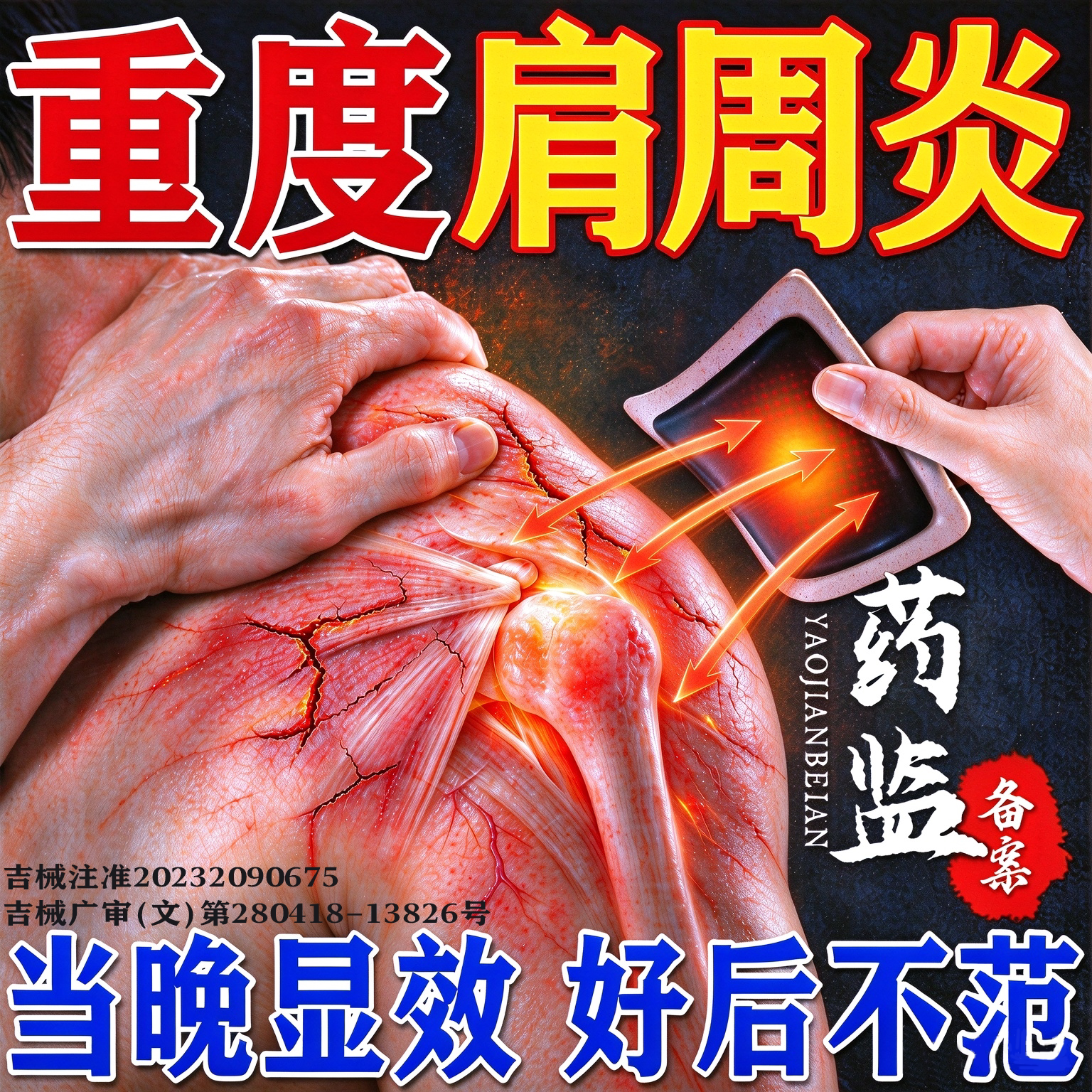 肩周炎专用膏药贴效特神器
