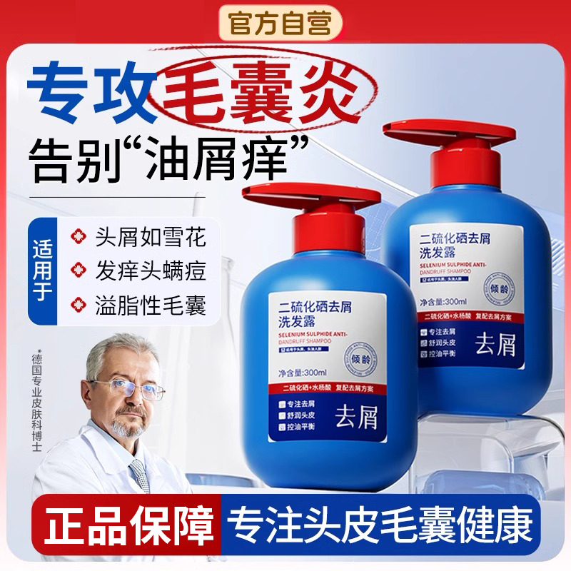 二硫化硒去屑洗发水露洗剂洗发露止痒倾龄官方正品旗舰男雪上女士