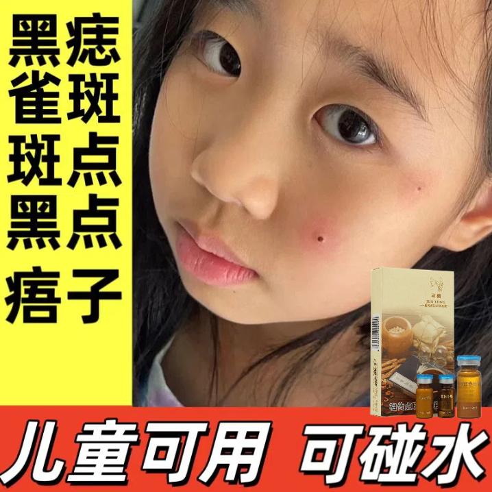 一次点掉美容院点斑点痣膏不留疤