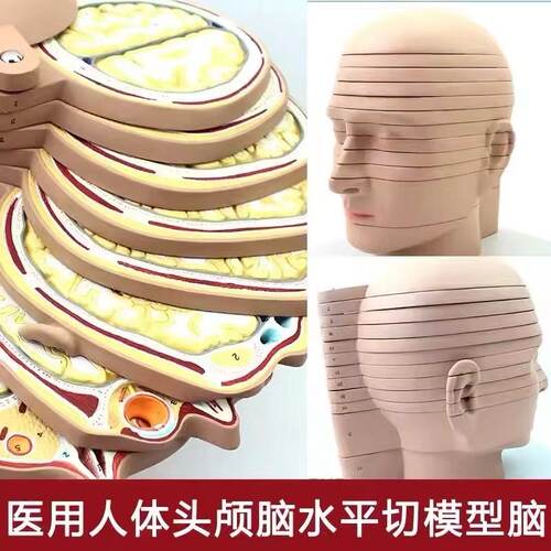 人体大脑头颅水平切头颅横切面断层CTMRI放射磁共振成像神经科模