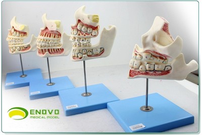 ENOVO颐诺儿童牙列与颌骨发育