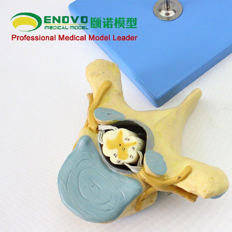 ENOVO颐诺医学人体胸椎附脊髓和脊神经放大模型神经骨科解剖模型