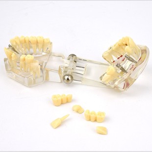 ENOVO颐诺口腔模型齿科种植阻生齿牙体牙髓口腔教学马里兰桥瓷贴