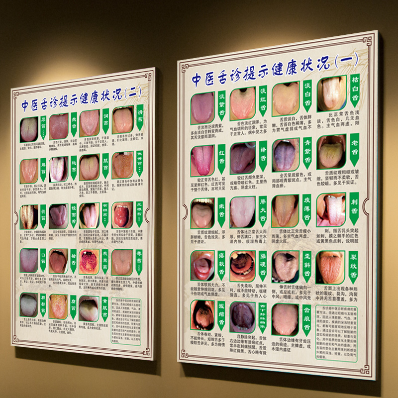 中医舌诊健康状况对照表图解医院挂图中医养生舌苔问题挂画宣传画