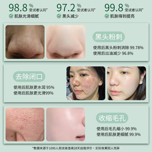 BST乳糖酸洗面奶粉刺闭口收缩毛孔碧素堂官方旗舰店N