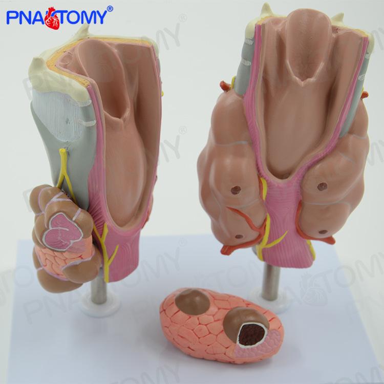 医用甲状腺模型病理教学