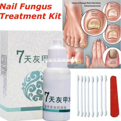 Anti Fungal Nail Infection Toe Nails Fungus Treatment Yellow