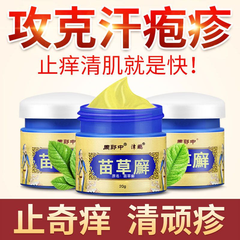 汗孢疹手上起水泡手痒足脚脱皮干裂汗疱宁专用乳膏季节性汗状泡疹