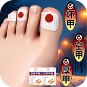 抑菌灭菌专用贴植物萃取脚趾手指甲通用 灰趾甲贴正品 假一罚十