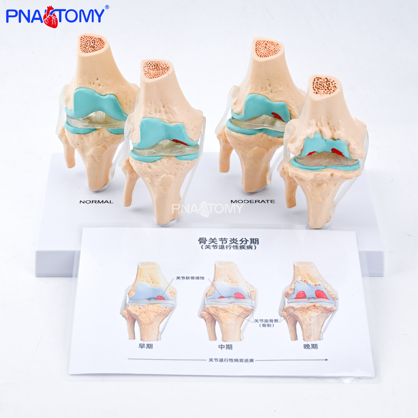 PNATOMY人体膝关节解剖教学模型图片