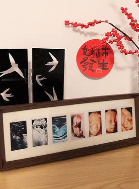 定制孕期四维nt彩超b超纪念相框宝宝婴儿记录相册摆台洗照片礼物