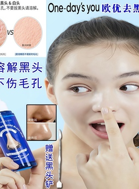 韩国One-day'sYOU欧优去黑头水皮脂唰唰 收毛孔溶解黑头导出液