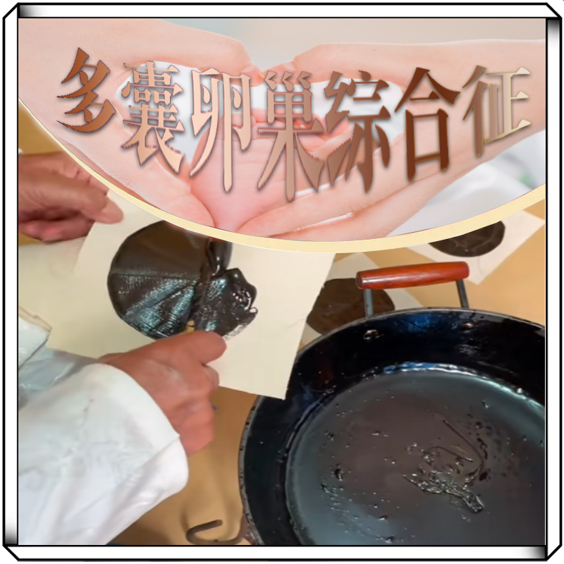 多囊卵巢综合征调理月经不调内膜薄量少闭经促排卵不孕中药药