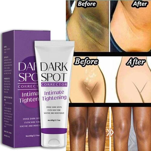 Whitening Cream Quickly Private Parts Dark Skin Underarm Bri