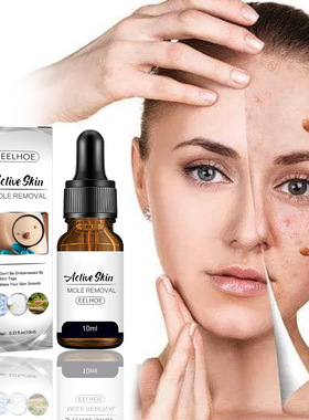 Free Shipping Wart Treatment Wart Removal Essence Neck Skin