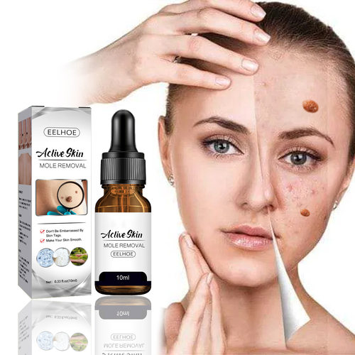 Free Shipping Wart Treatment Wart Removal Essence Neck Skin