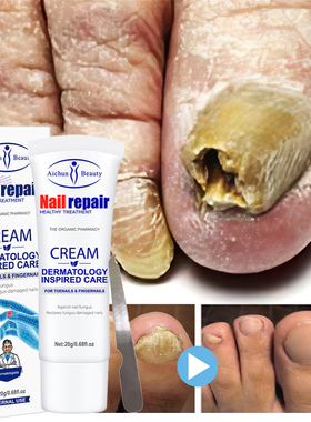 Effective Nail Fungus Treatment Cream Foot Toe Nail Fungus R