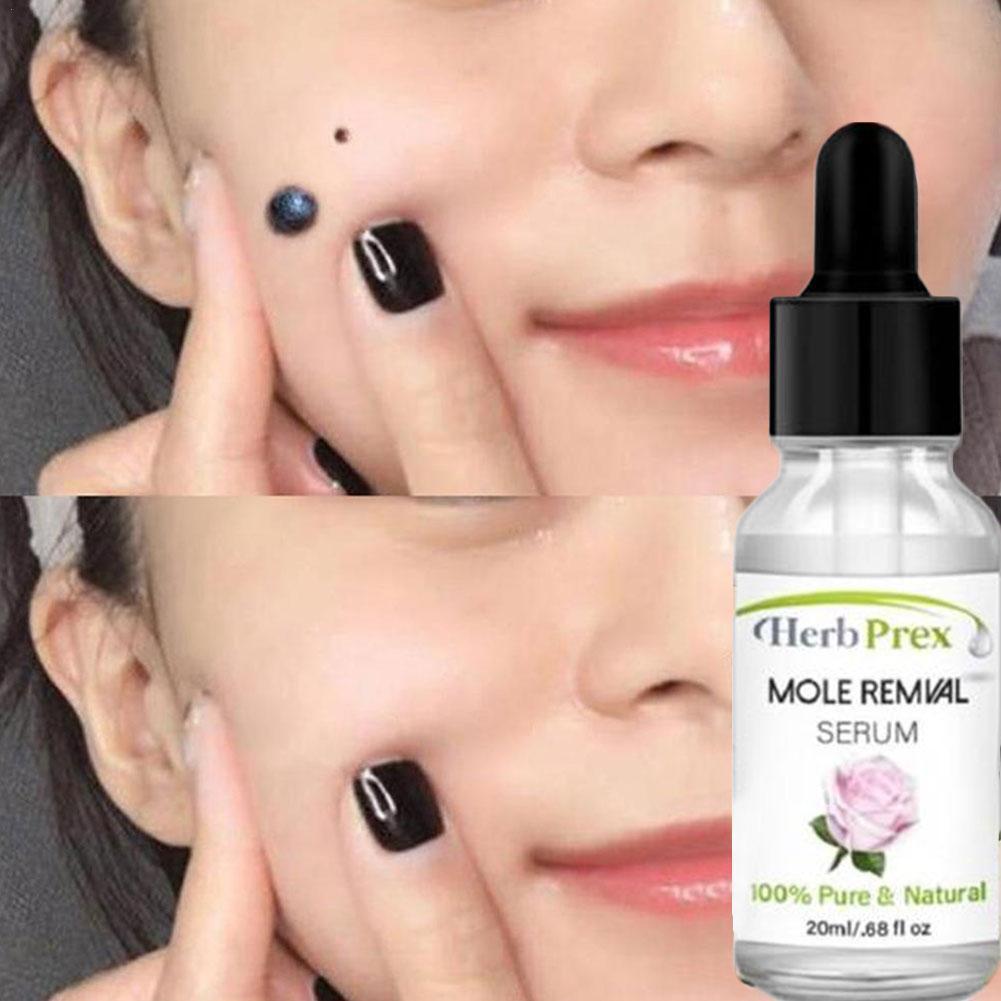 Skin Tag Removal Solution Painless Mole Skin Dark Spot Remov