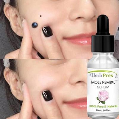 Skin Tag Removal Solution Painless Mole Skin Dark Spot Remov
