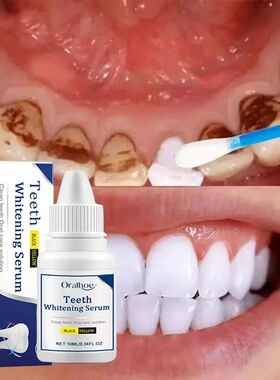 Cleaning Tooth Whitening Serum Remove Plaque White Teeth Gel