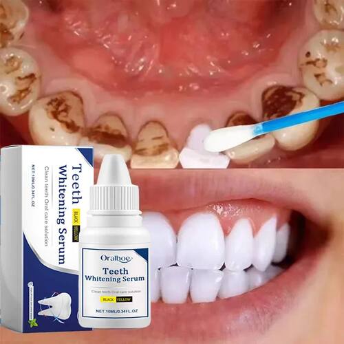 Cleaning Tooth Whitening Serum Remove Plaque White Teeth Gel
