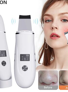 Ultrasonic Face Scrubber Facial Peeling Skin Scrubber Deep F