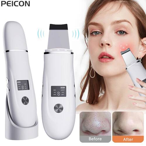 Ultrasonic Face Scrubber Facial Peeling Skin Scrubber Deep F