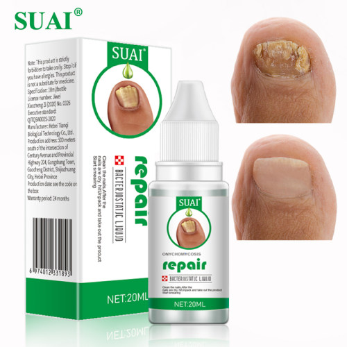 20ML Nail Fungal Treatment Feet Care Essence Nail Foot Toe N