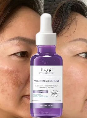Powerful Dark Spots Remover Freckle Whitening Serum Melanin