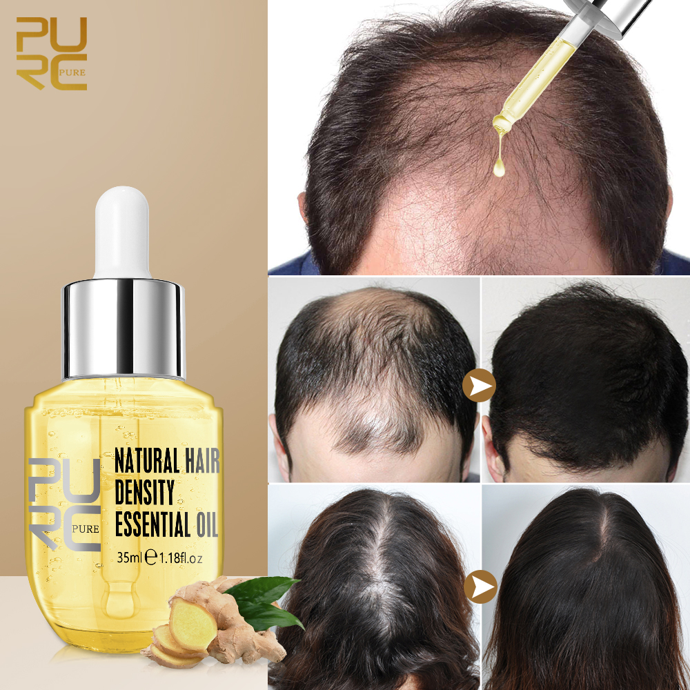 Ginger Hair Growth Products Prevent Hair Loss Essential Oil 彩妆/香水/美妆工具 化妆/美容工具 原图主图