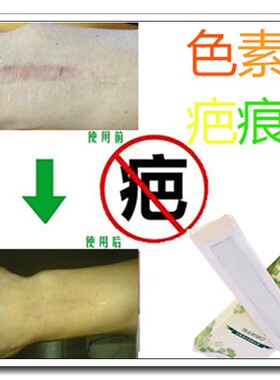 去黑色素沉着淡化增生疙瘩贴祛除男女士暗沉红印抓痕黑印痘疤痕印