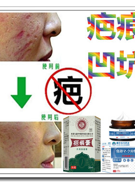祛凹凸疤去除黑色素沉淀红印伤疤贴淡化黑印痘疤痕印修复药膏正品