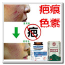 草本祛黑色素沉着回流色素印痕霜淡化抓痕黑印红印产品正品 药膏贴