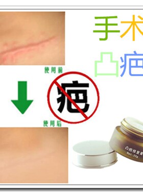 去除脸部伤疤痕印修复增生性凸起消平贴淡化暗沉红印祛手术刀疤膏