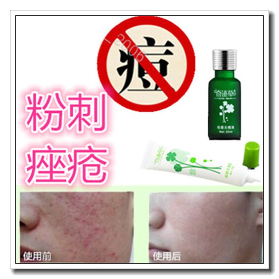 消祛后背青春痘痘印药膏护肤品豆豆肌套装去除脸部结节性痤疮正品