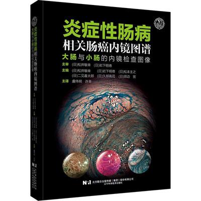 炎症肠病相关肠癌内镜图谱:大肠与小肠的内镜检查图像松井俊行  医药卫生书籍