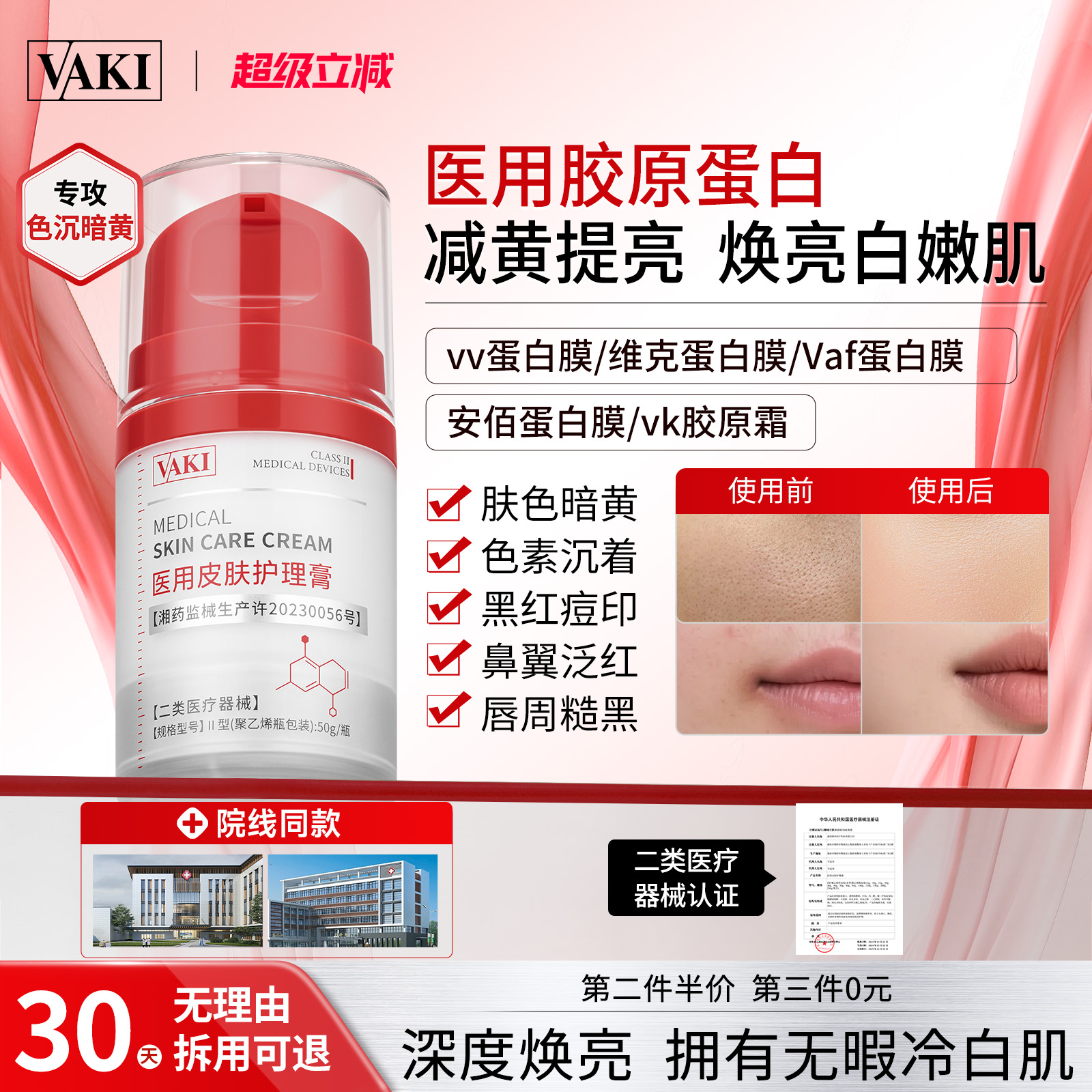 维克蛋白膜Vaf蛋白膜Vv蛋白膜Vk胶原膜安佰蛋白膜Vaa蛋白膜