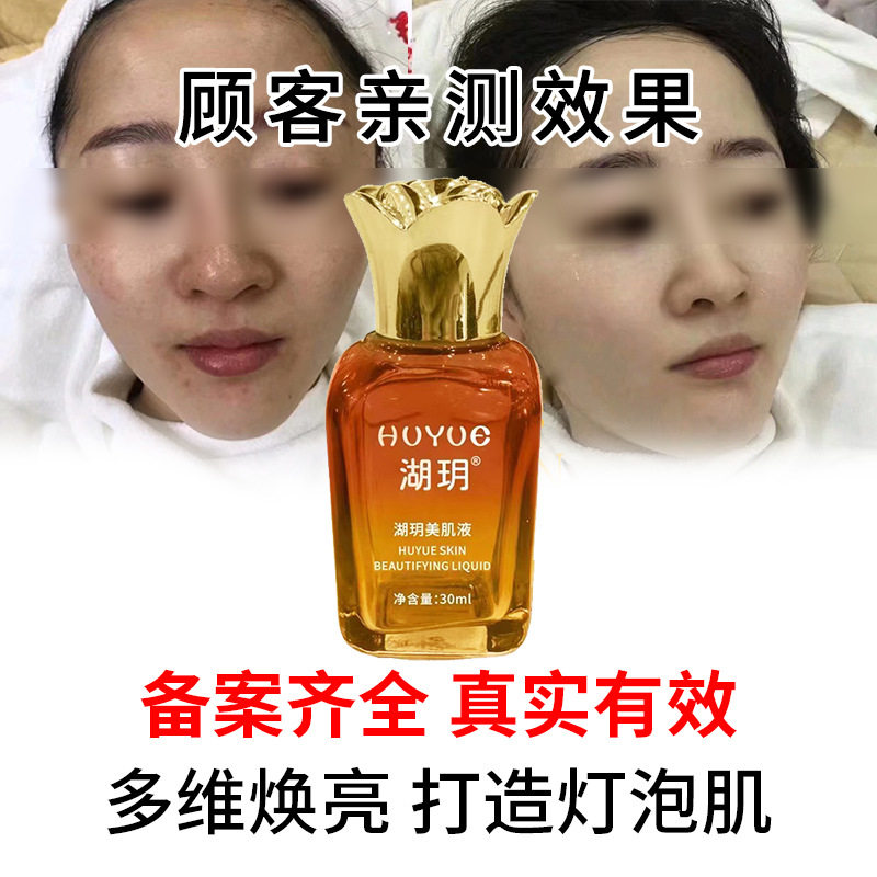 改善暗沉黄褐斑排铅汞美容院臭臭水紧致臭水疏基水亮肤美肌液套盒