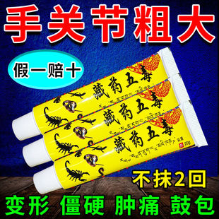 手指疼痛骨节粗大变形手指疙瘩鼓包骨肿大 藏药五毒膏