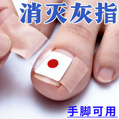 【正品专用】修趾甲贴植物萃取指甲灰贴正甲手指专用贴指甲膏贴