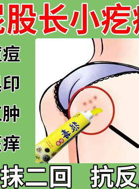 屁股上长疙瘩起痘痘久坐痒膏湿痒拔毒热毒红疙瘩私处膏