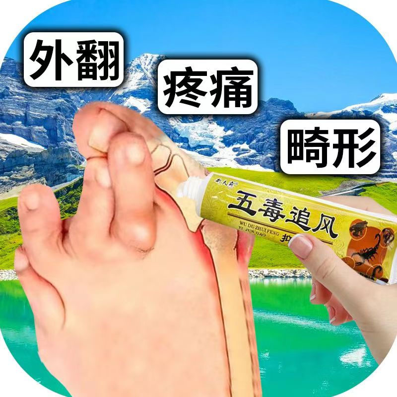 脚拇指外翻矫正器大脚骨宽头脚严重外翻关节痛重叠矫正